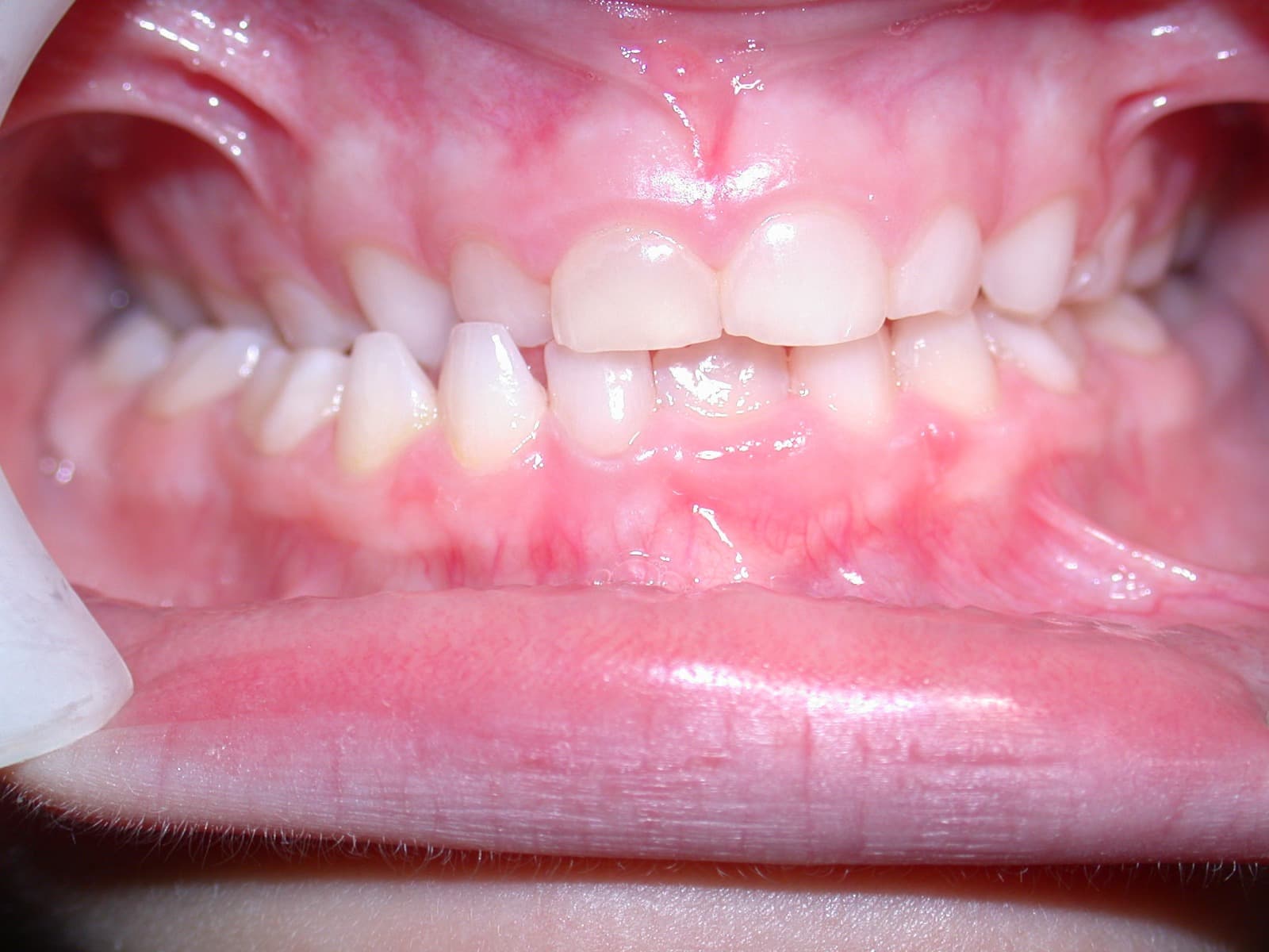 Preparation — Week 2