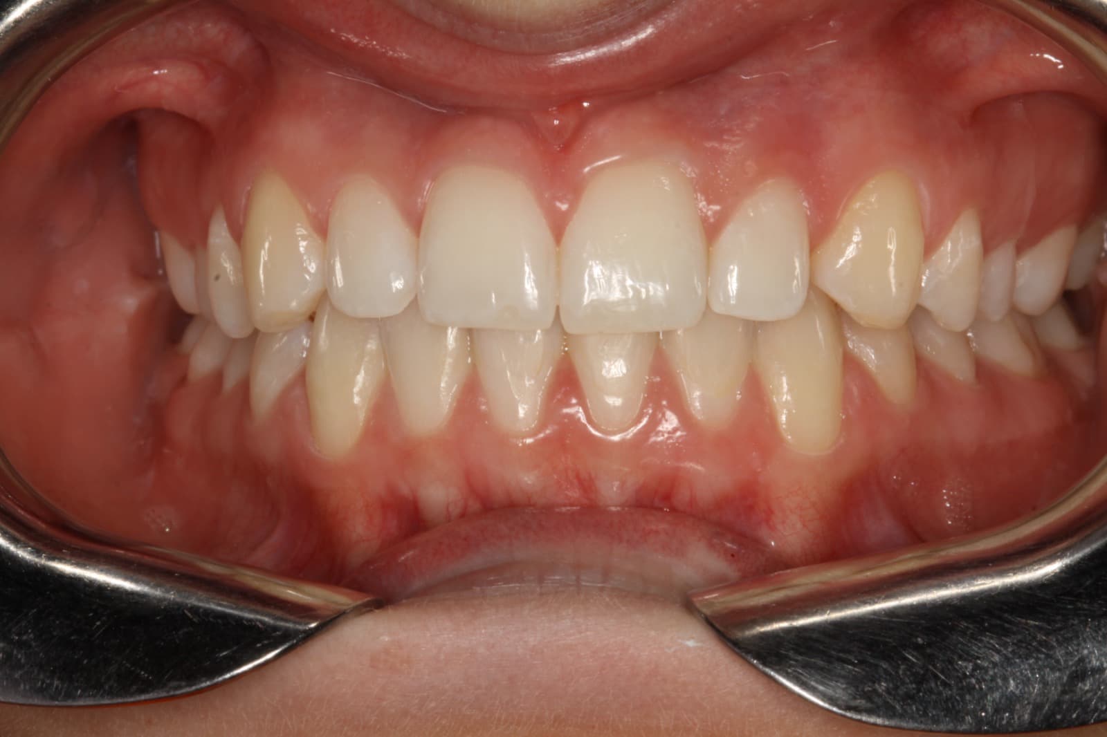 Completed — Month 6