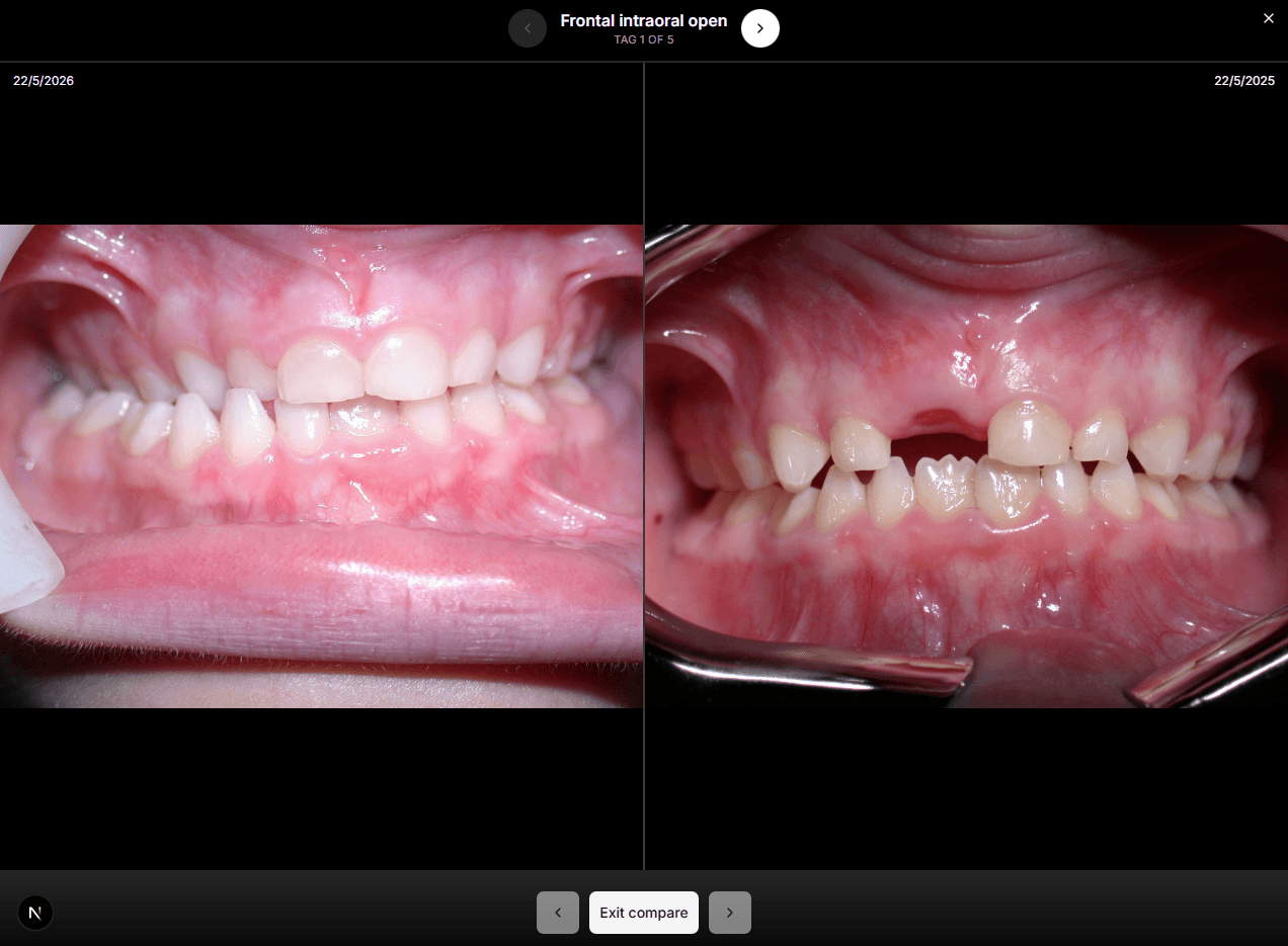 Side-by-side comparison of patient photos at different visits