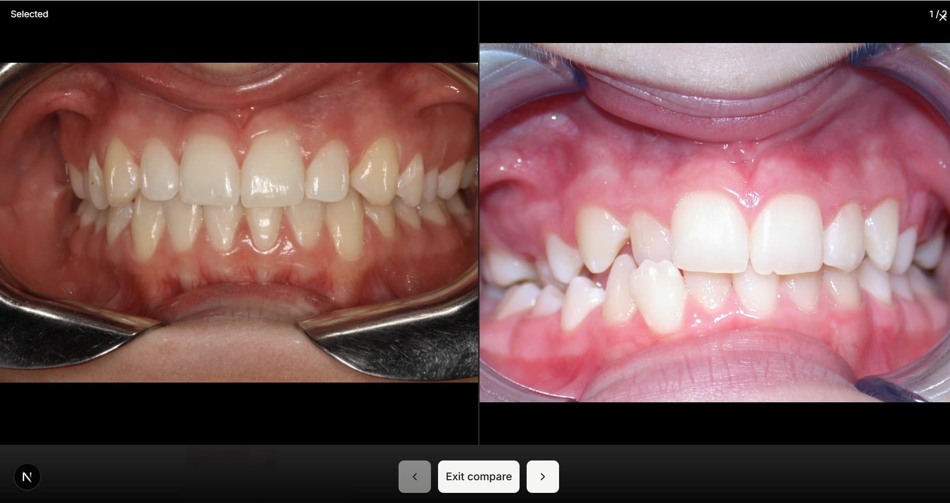 Compare photos side by side