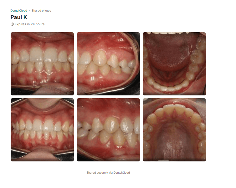 Shareable portfolio link preview showing dental case photos